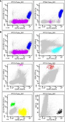 The ALLgorithMM: How to define the hemodilution of bone marrow samples in lymphoproliferative diseases